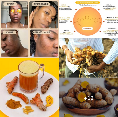 5 VÉRITÉS- CHOC AU SUJET DU CURCUMA !!!*
